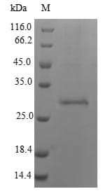 Calloselasma rhodostoma SLYB Protein (Recombinant 6His-B2M, N-terminus)