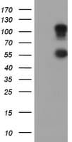 Monoclonal Mouse anti-Human SPINT1 / HAI-1 Antibody (clone OTI4E1, IHC, IF, WB)