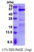 Human GALT Protein (Recombinant His)