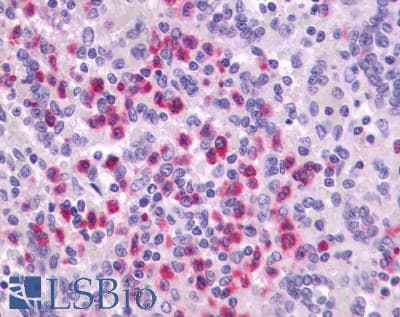 IHC-plus™ P2RY4 / P2Y4 Antibody (Extracellular Domain)