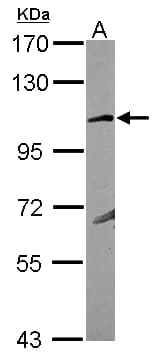 GRIK4 / KA1 Antibody (N-Terminus)