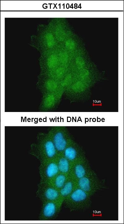MAGEA11 Antibody (aa78-173)
