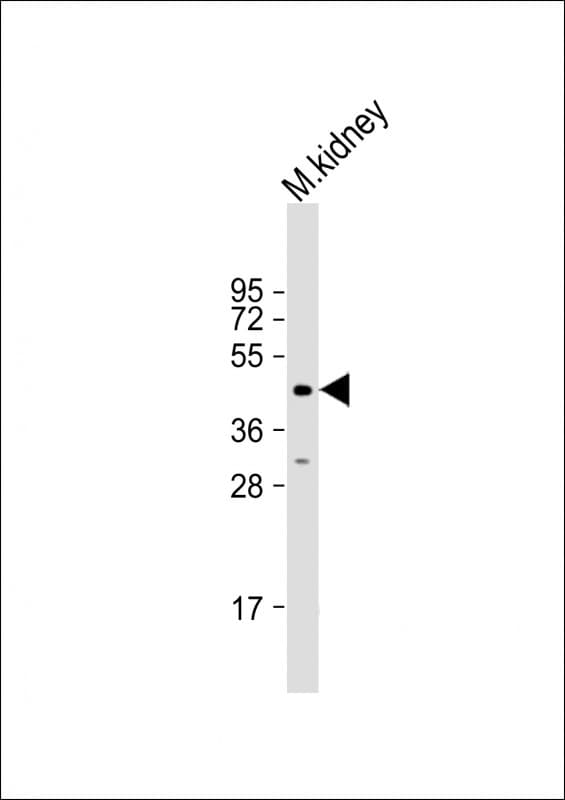 ACP6 Antibody (N-Terminus)