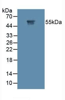 MMP11 Antibody (aa277-489, Biotin)