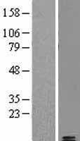 IAPP / Amylin Protein (Over-Expression Lysate Myc-DDK (Flag))