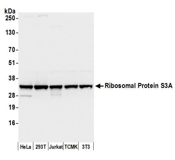 Polyclonal Rabbit anti-Human RPS3A / Ribosomal Protein S3A Antibody (aa214-264, IHC, WB)