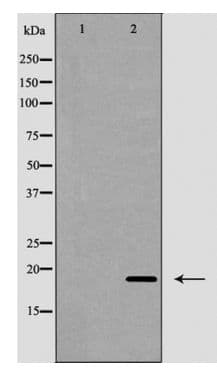 Polyclonal Rabbit anti-Human IFN Gamma / Interferon Gamma Antibody (IHC, WB)