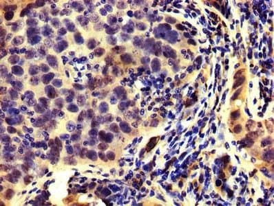 Polyclonal Rabbit anti-Human HMG-CoA Reductase / HMGCR Antibody (IHC, WB)