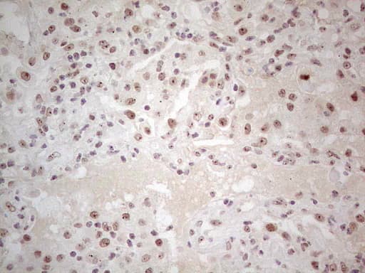 ERCC1 Antibody (clone OTI5E2)