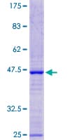 Human MGC34774 Protein (Recombinant GST, N-terminus)