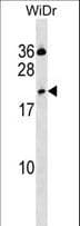 CLEC2D / OCIL / LLT1 Antibody (aa109-137)