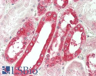 IHC-plus™ Polyclonal Rabbit anti-Human DAP Antibody (aa52-102, IHC, WB)