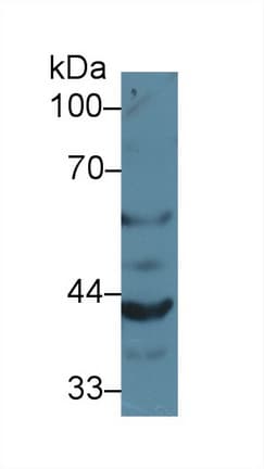 GRN / Granulin Antibody (aa31-269)