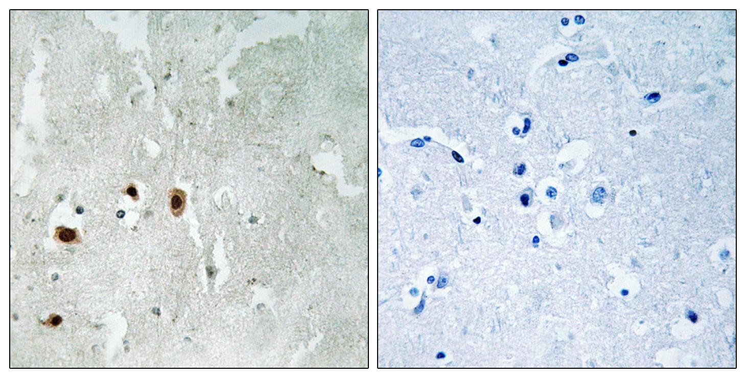 KAT5 / TIP60 Antibody (phospho-Ser90)