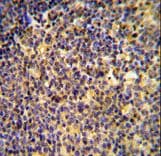 ANKRD44 Antibody (aa481-510)