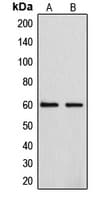 IHC-plus™ CYP4F2 Antibody (N-Terminus)