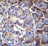 Polyclonal Rabbit anti-Human HIP1R Antibody (aa98-126, IHC, WB)