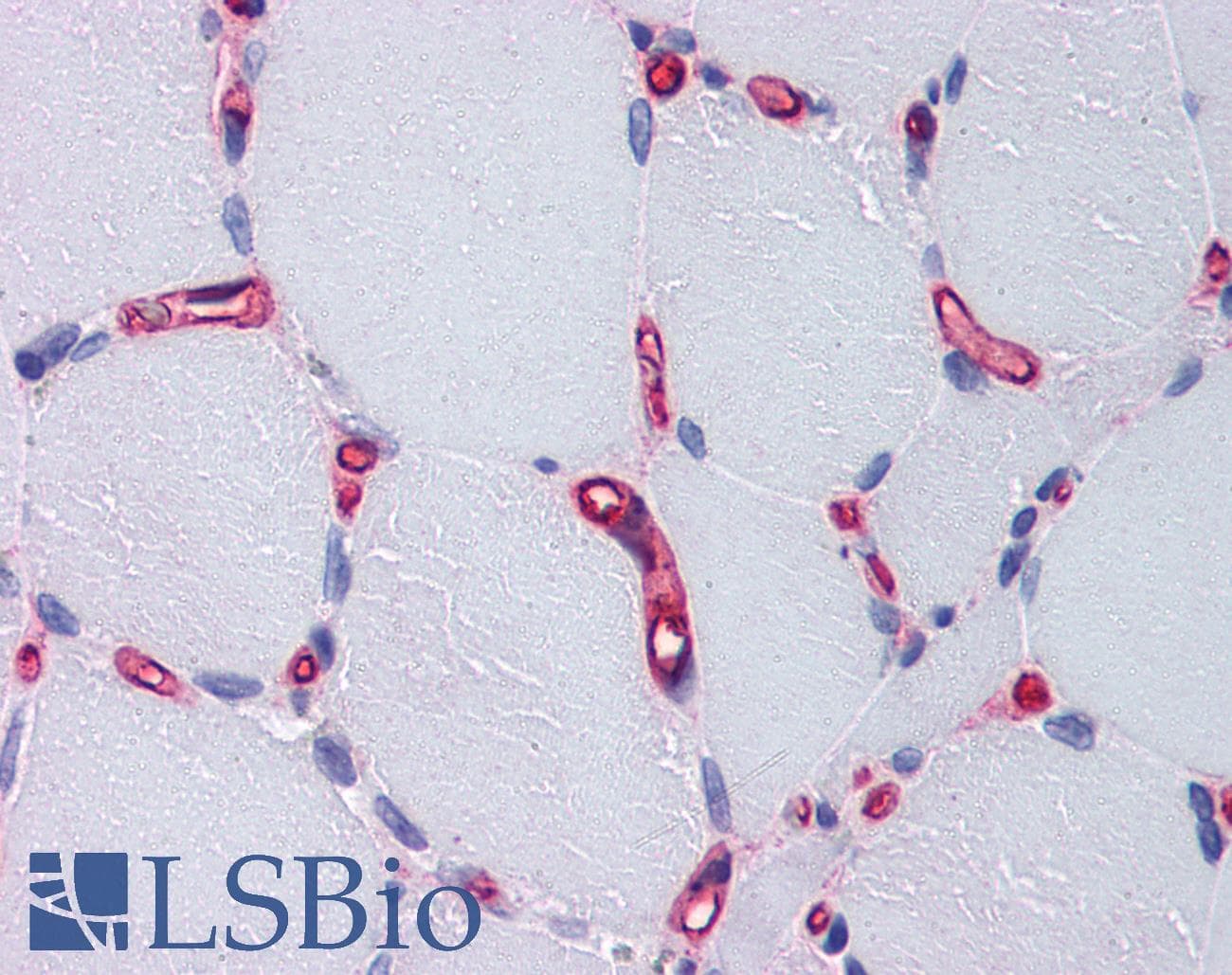 IHC-plus™ F8 / FVIII / Factor VIII Antibody