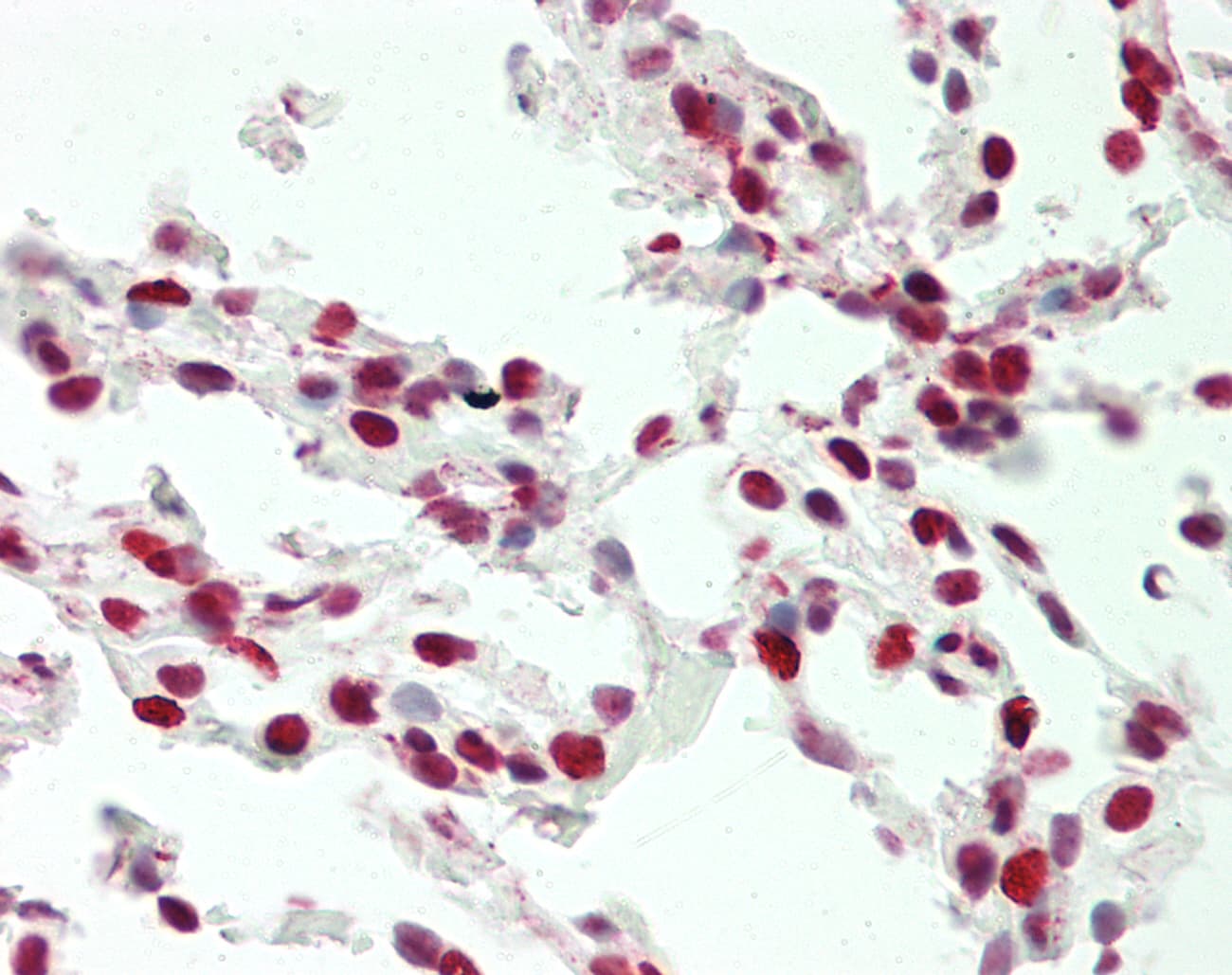 UBTF / UBF Antibody (aa362-411)