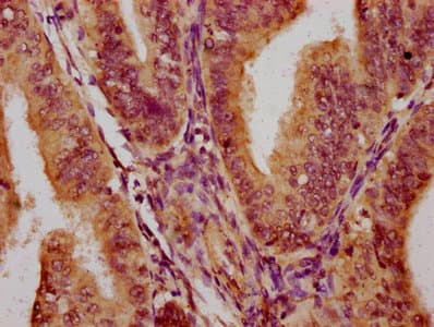 Polyclonal Rabbit anti-Human PARS2 Antibody (IHC)