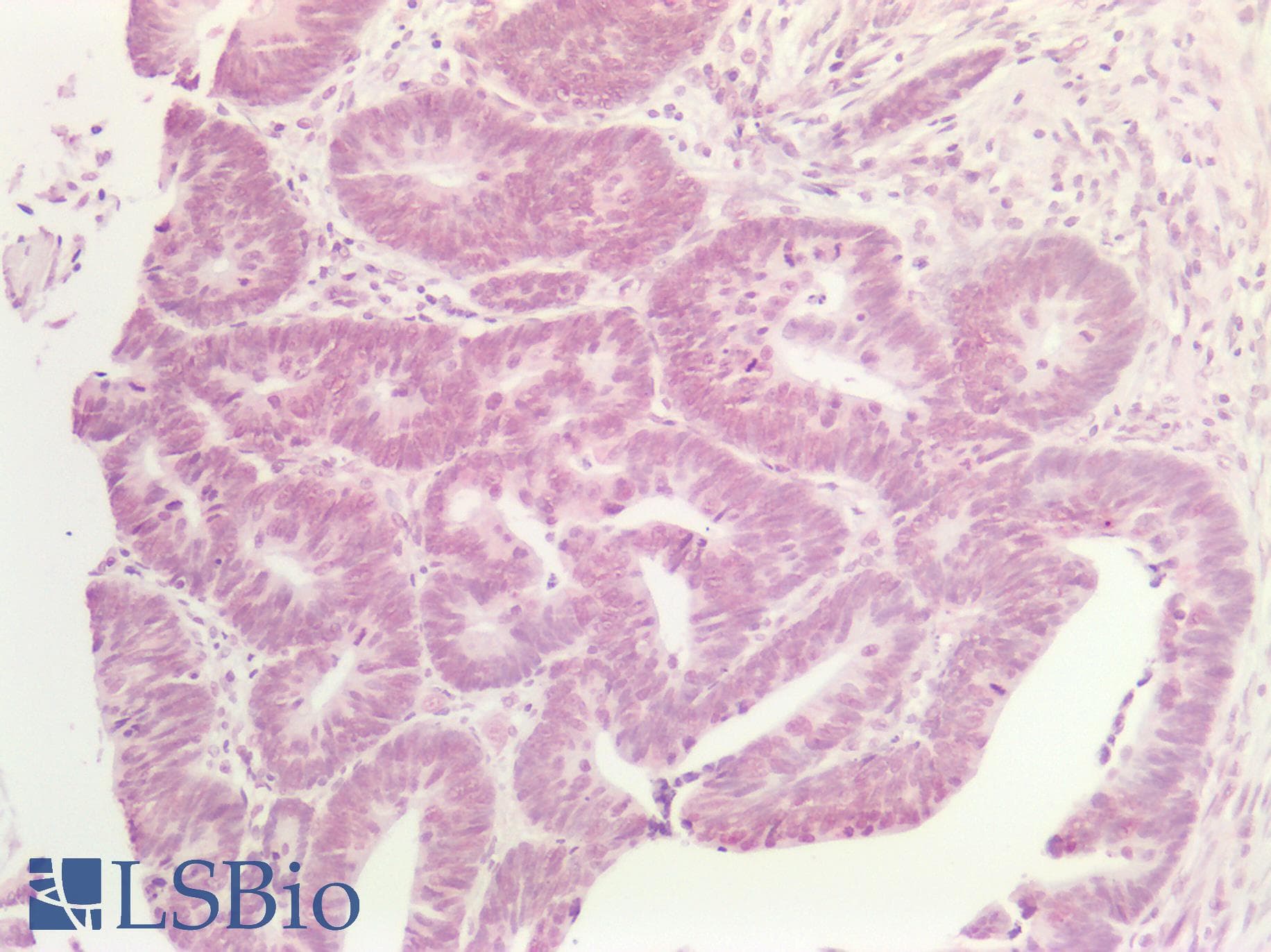PathPlus™ DNMT / DNMT1 Antibody (aa637-650, clone 60B1220.1)