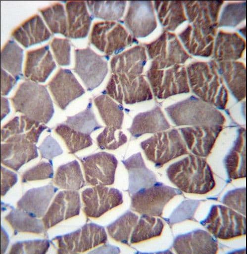 NPHP3 Antibody (aa144-173)