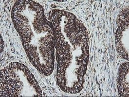 NDUFB10 Antibody (clone OTI4F1)