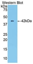 CPB2 / TAFI Antibody (aa113-422)