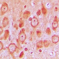 SRC Antibody (phospho-Ser75)