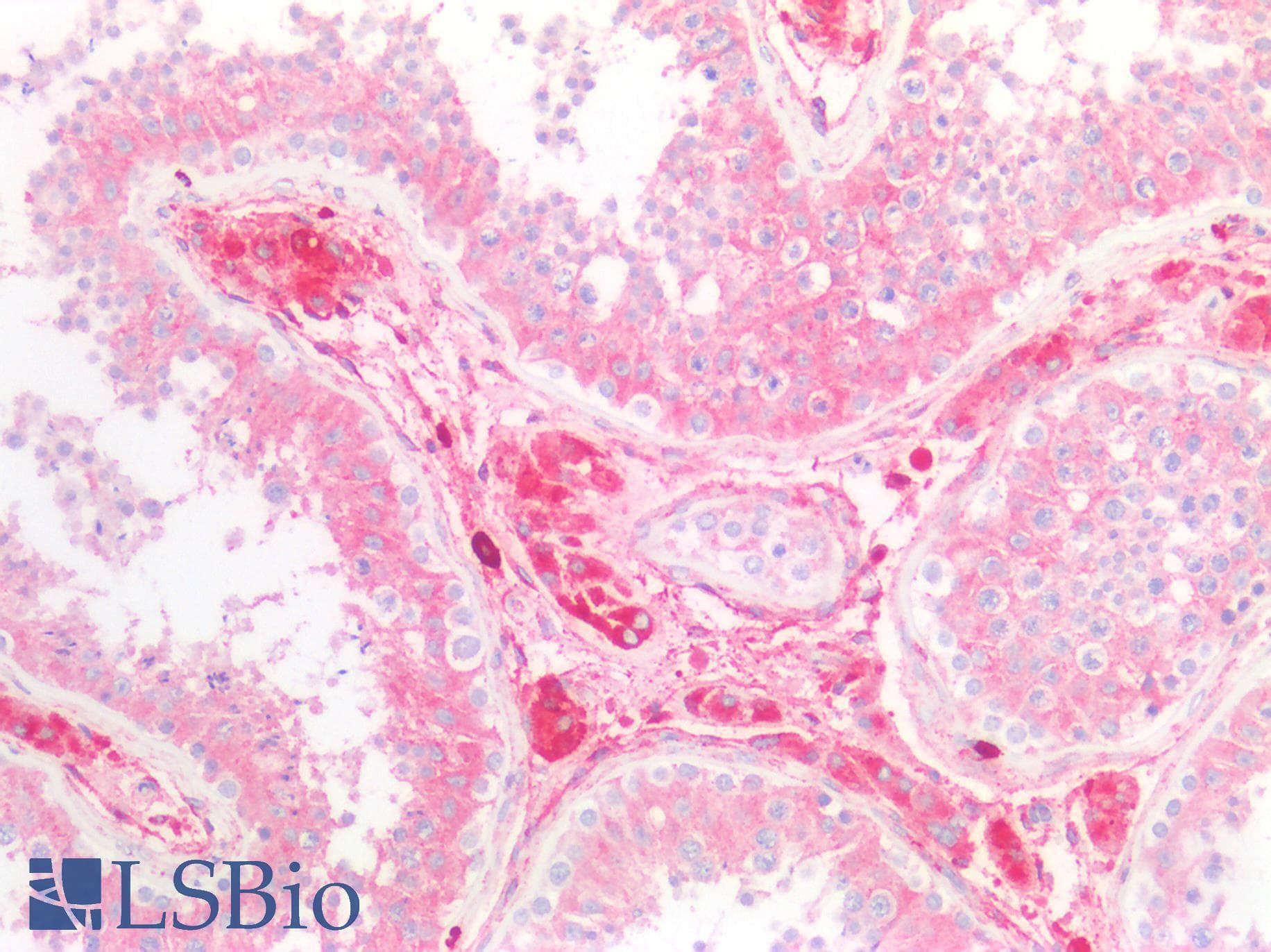 PathPlus™ CD63 Antibody (clone MX-49.129.5)
