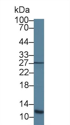 ACYP1 Antibody (aa1-99, APC)