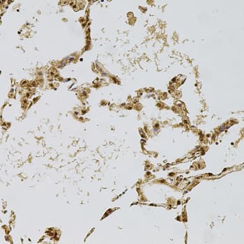 PLK4 / SAK Antibody