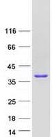 Human DHRSX Protein (Recombinant Myc-DDK (Flag))