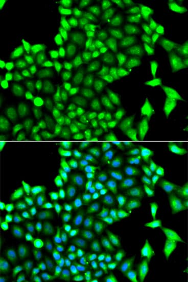Polyclonal Rabbit anti-Human PIP4K2A / PIPK Antibody (IHC, IF, WB)