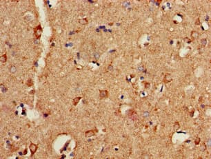 P2RX1 / P2X1 Antibody