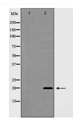 CAV1 / Caveolin 1 Antibody