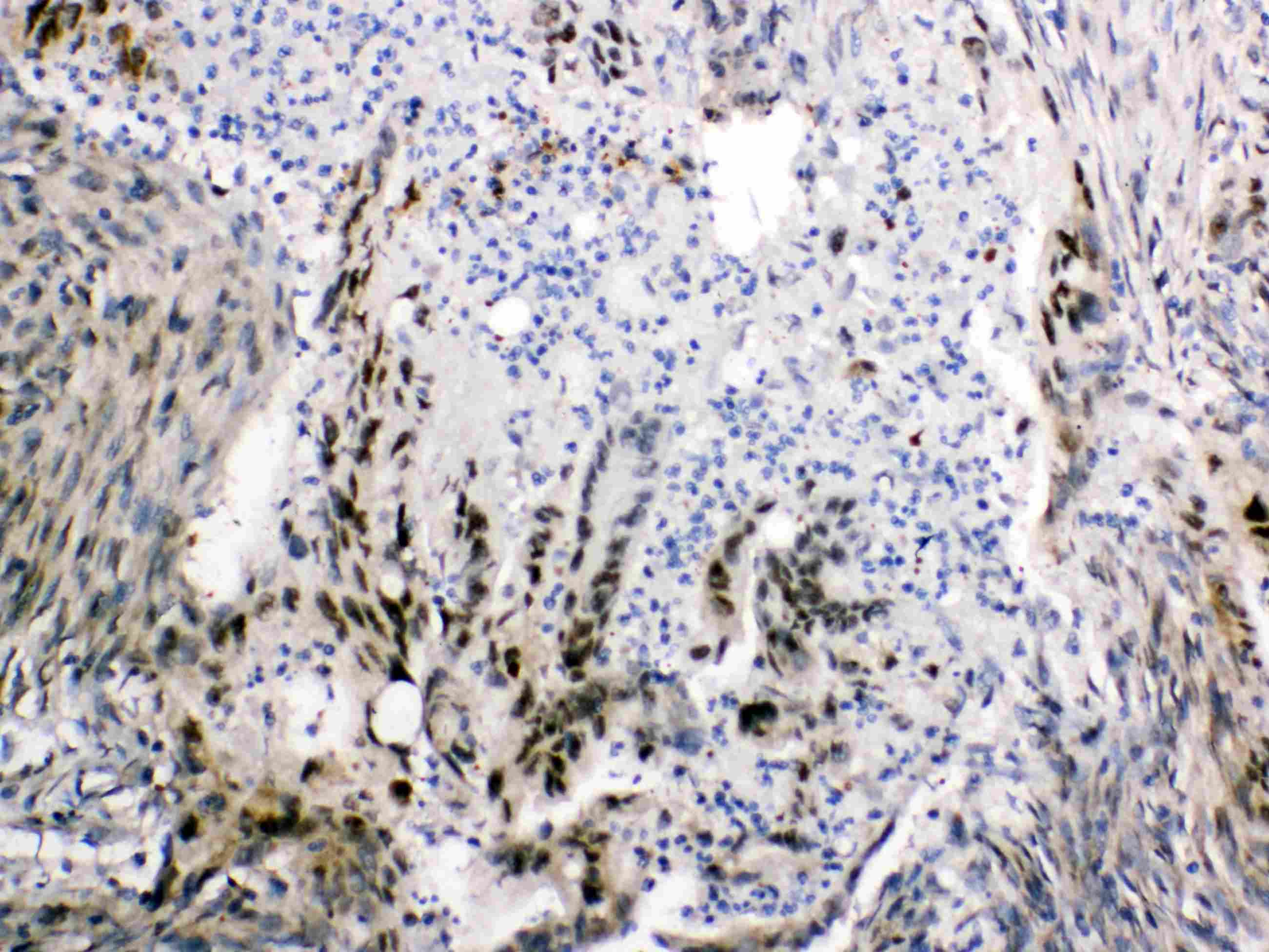 Polyclonal Rabbit anti-Mouse I-FABP / FABP2 Antibody (IHC, WB)