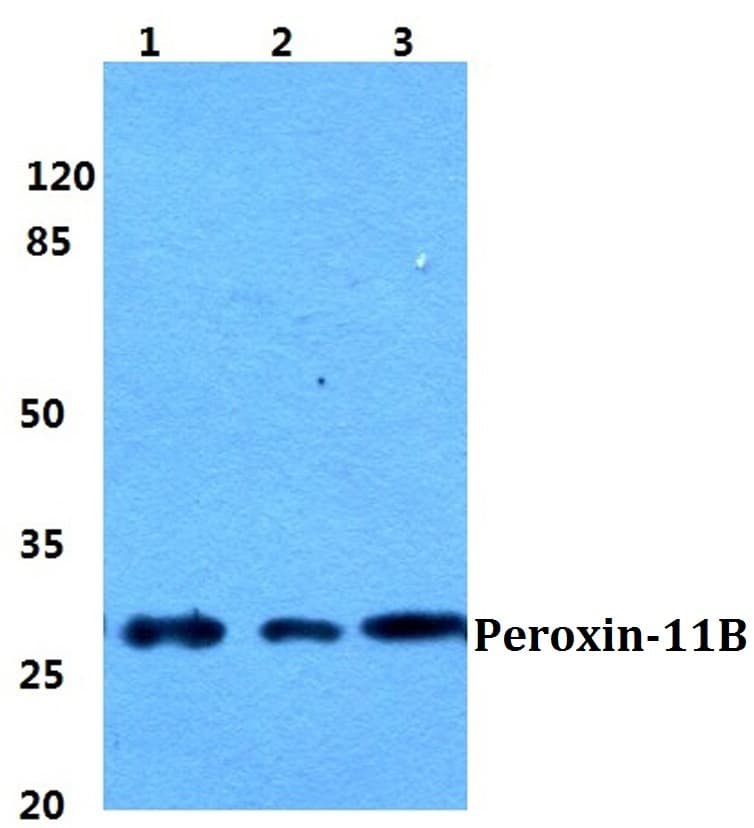 IHC-plus™ PEX11B Antibody (aa132-177)