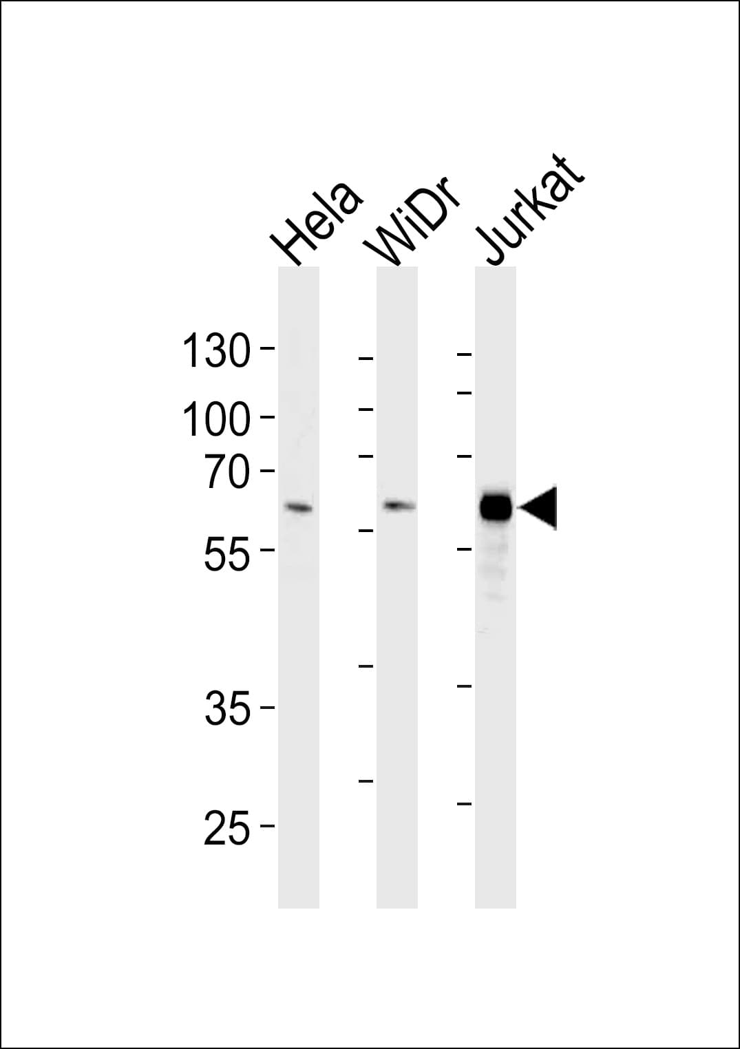HDAC1 Antibody (clone 1061CT1.3.1)