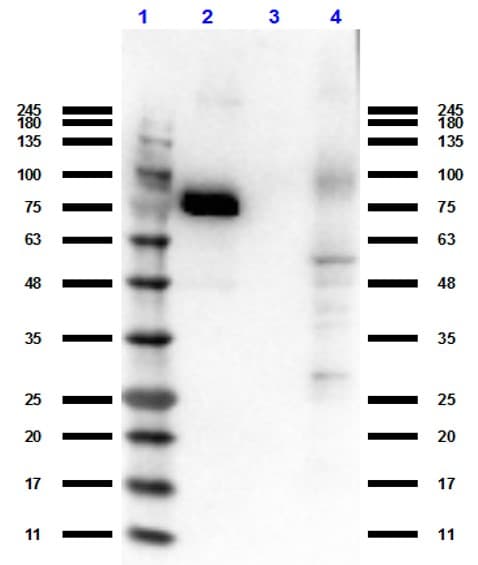 Polyclonal Rabbit anti-Human MST1R / RON Antibody (WB)