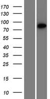 XRRA1 Protein (Over-Expression Lysate Myc-DDK (Flag))