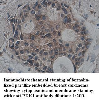 Polyclonal Rabbit anti-Human PDK1 Antibody (C-Terminus, IHC)