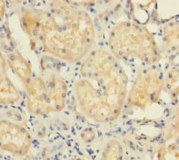 Polyclonal Rabbit anti-Human FAT10 / UBD Antibody (aa1-165)