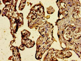 Polyclonal Rabbit anti-Human C3orf14 Antibody