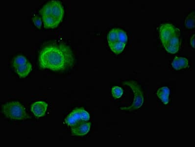 Polyclonal Rabbit anti-Human INSIG1 Antibody (IHC, IF, WB)