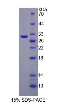 Rat GPA33 / A33 Protein (Recombinant His-S)
