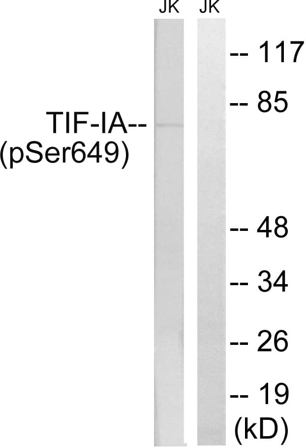 TIF-IA / RRN3 Antibody (phospho-Ser649)