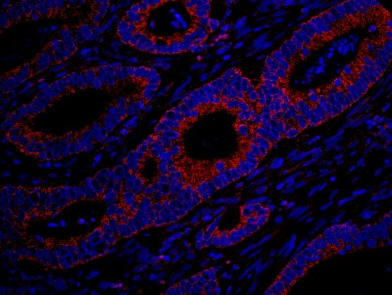 DENN / MADD Antibody (aa1597-1647)