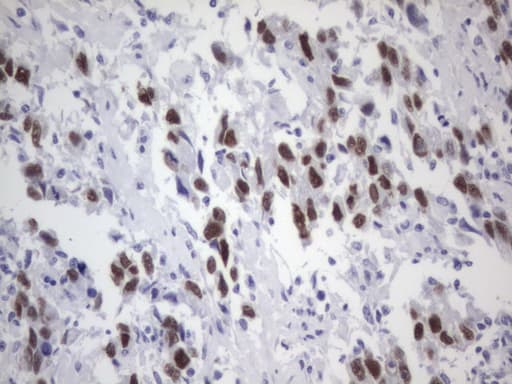 ER Alpha / Estrogen Receptor Antibody (aa1-310, clone OTI2D3)