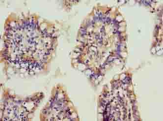OSER1 / C20orf111 Antibody